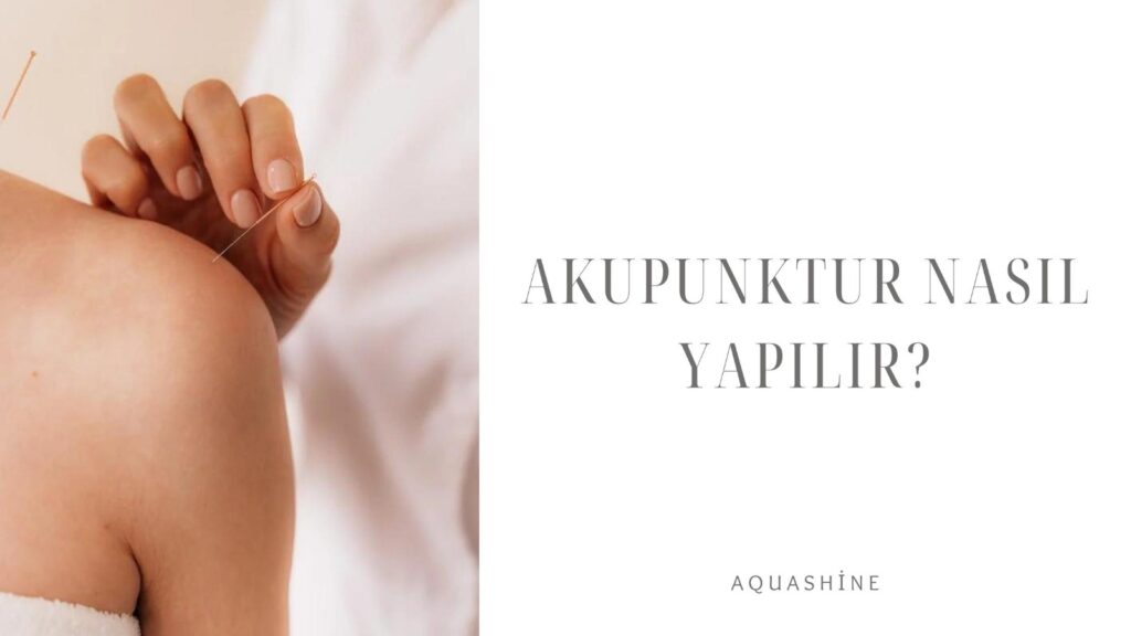 Akupunktur Nasıl Yapılır?