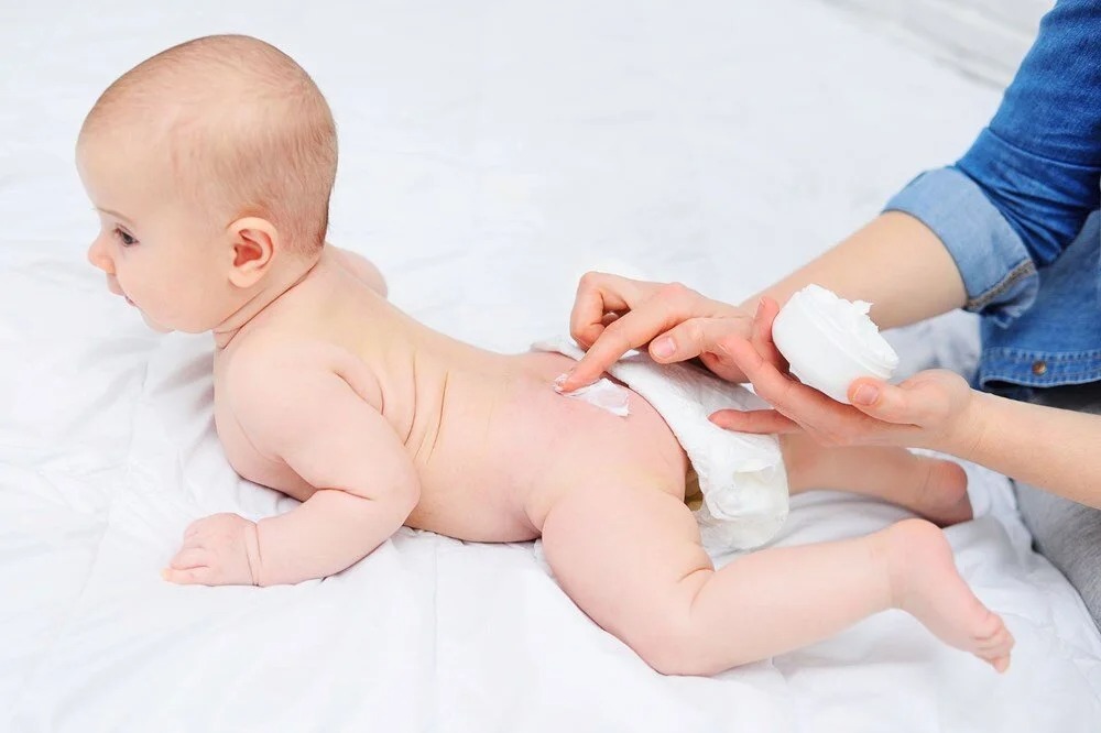 Sudocrem Nedir ve Ne İşe Yarar?